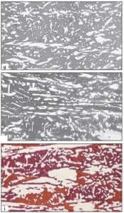 Figure 20.4-b Selective coloring of ferrite in a duplex stainless steel by electrolytic etching with g) aqueous 20% NaOH (4V DC, 10 seconds) and with h) aqueous 10 N KOH, (3 V DC,4 seconds); and by immersion color etching i) with Beraha’s reagent (100mℓ water, 10mℓ HCl and 1g K2S2O5) at 200X.