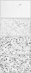 Figure 20.5 Microstructure of WC-Co cutting tool: a) as-polished revealing graphite particles; b) relief polished revealing the cobalt binder phase; c) after immersion in Chaporova’s etch (HCl saturated with FeCl3) to attack and “darken” the cobalt; and, d) after (c) plus Murakami’s reagent to outline the WC grains (1000X).