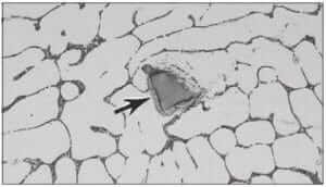 Figure 3.1 SiC grit particle (arrow) embedded in a 6061-T6 aluminum weldment (500X, aqueous 0.5% HF).