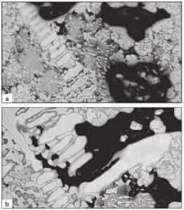 Figure 3.10 Differences in relief control in a brazed specimen containing shrinkage cavities: a) poor control; and, b) good control (100X glyceregia).