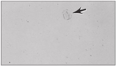 Figure 3.8 Staining (arrow) on the surface of a of Ti-6% Al-2% Sn-4% Zr-2% Mo prepared specimen (200X).