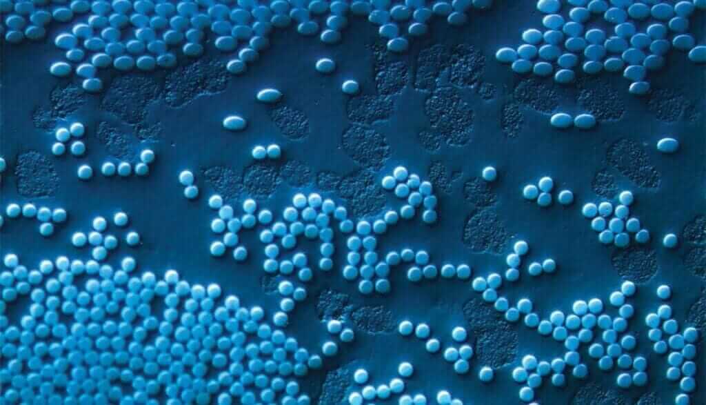 Buehler Announces Expansion of Relationship with Berg Engineering